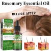 Rose Essential Oil For Hair Growth Nutrient Solution Hair Growth