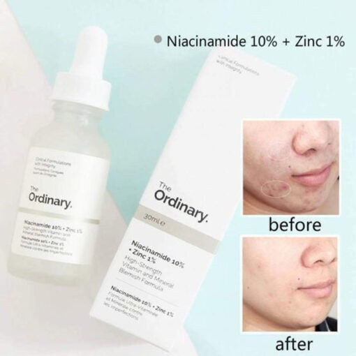 Niacinamide 10% + Zinc 1% With Batch Code The Ordinary Serum